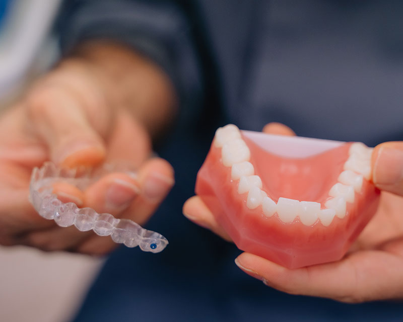 manos de un odontólogo del centro dental torres mostrando un aparato de ortodoncia invisible y una mandíbula artificial para colocarlo