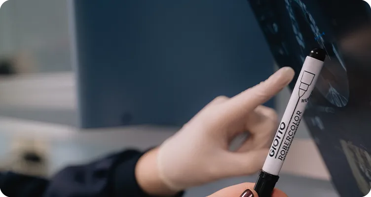 implantes dentales sin hueso