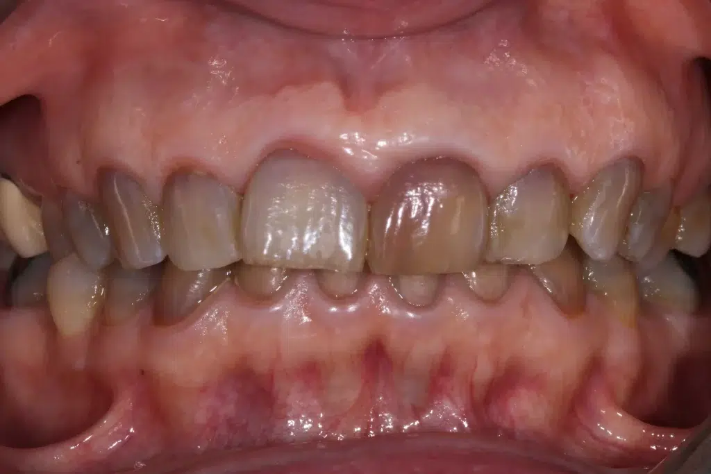 rehabilitacion oral zaragoza