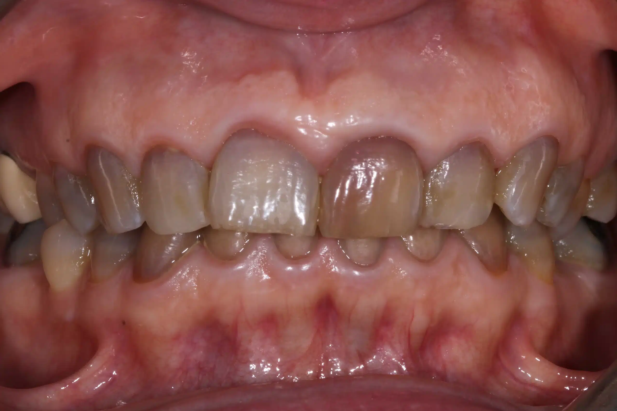 rehabilitacion oral zaragoza