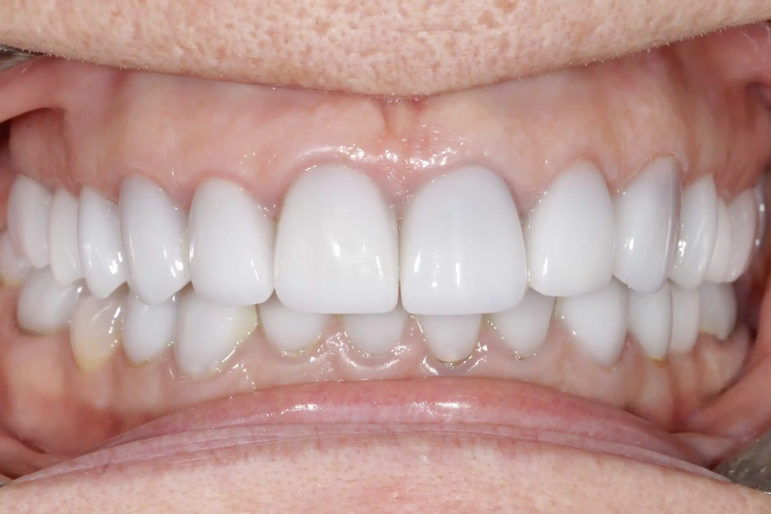 rehabilitacion oral zaragoza