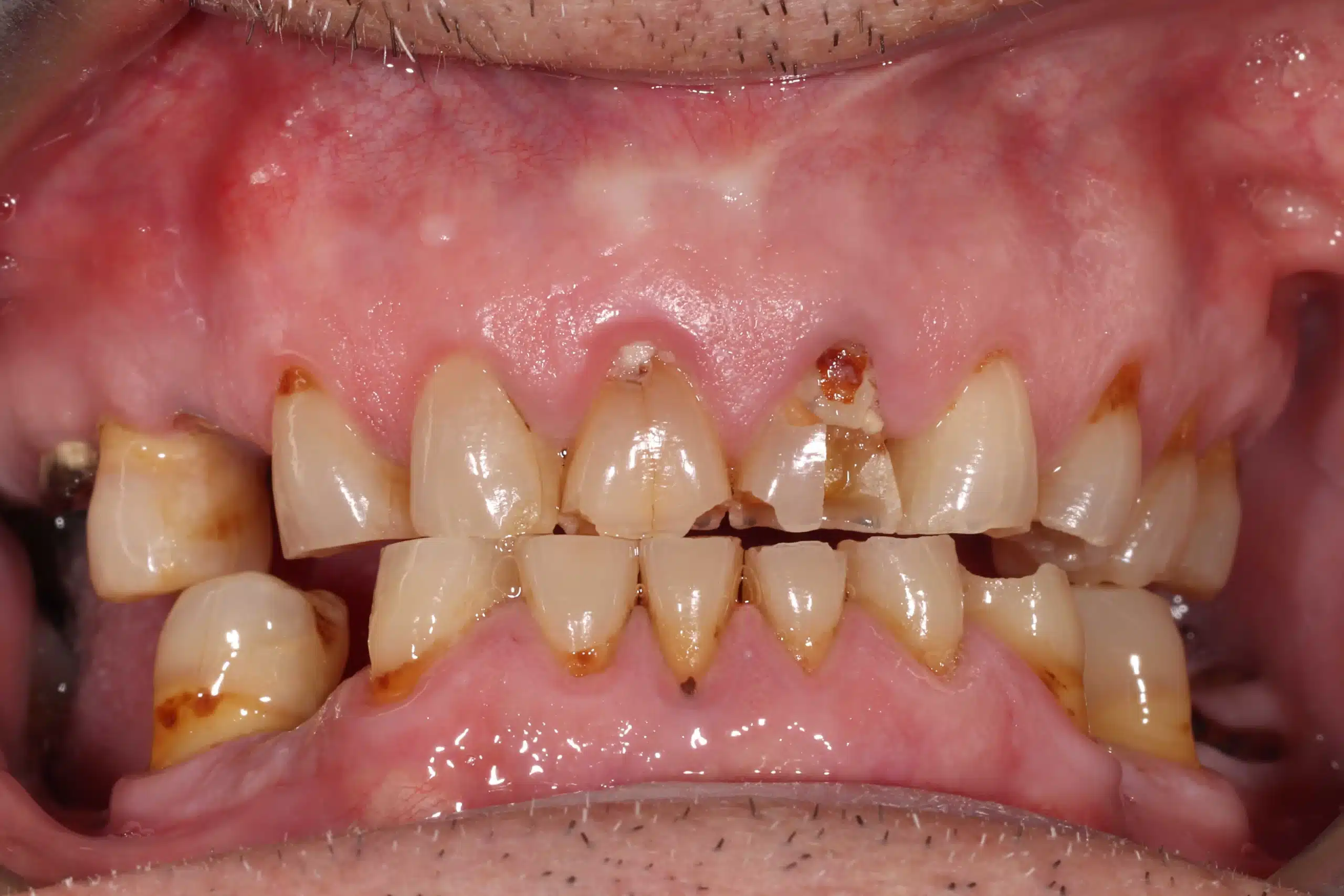 rehabilitacion oral zaragoza