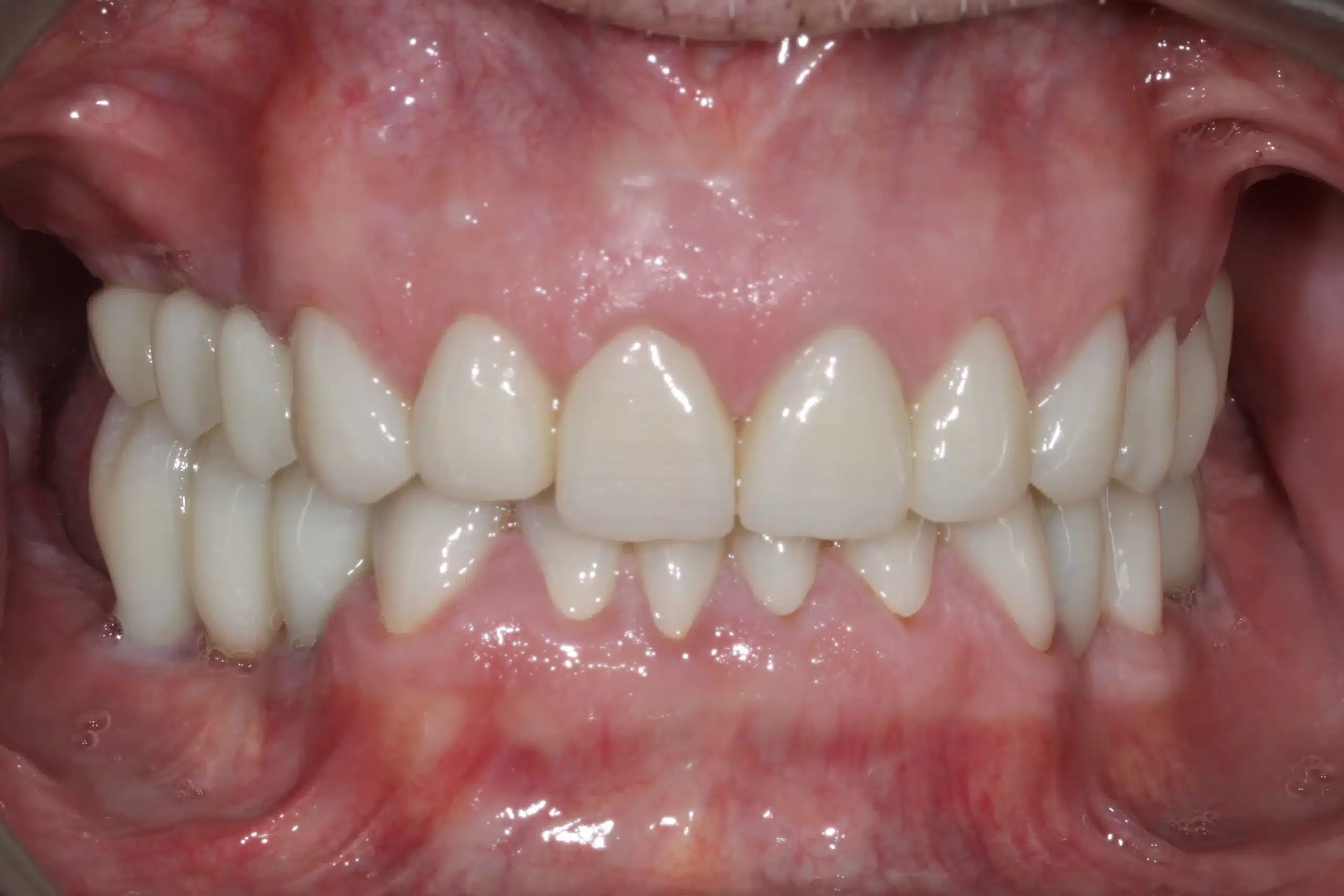 rehabilitacion oral zaragoza