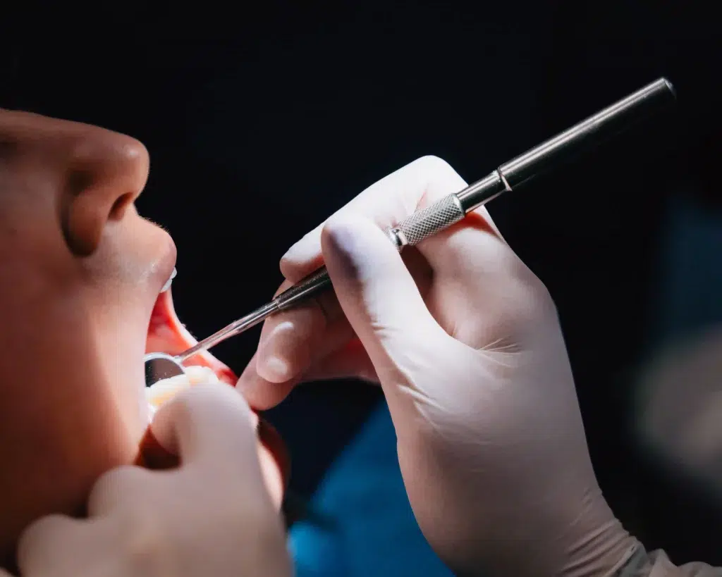 Piorrea (periodontitis avanzada): cómo saber si la tienes y qué puedes hacer para conservar tus dientes protector bucal deportivo