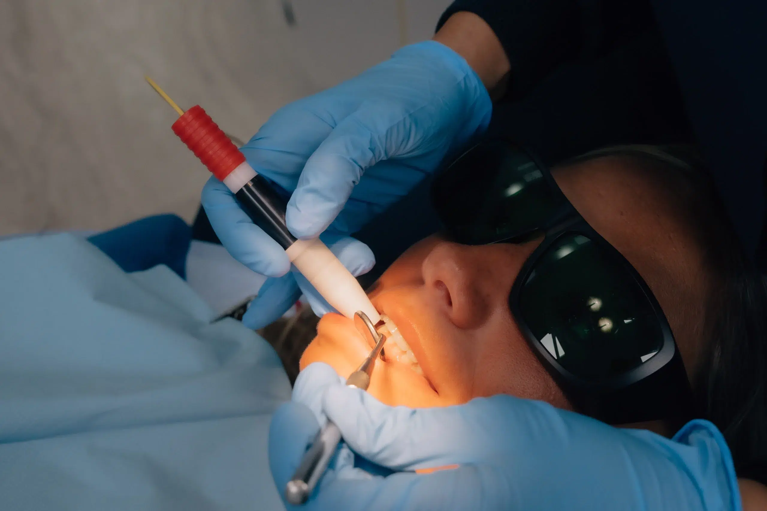 Estética dental Sonrisa Gingival zaragoza