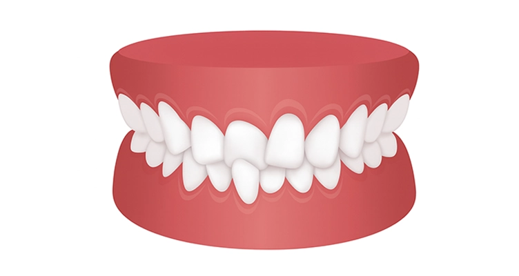 ortodoncia adultos zaragoza