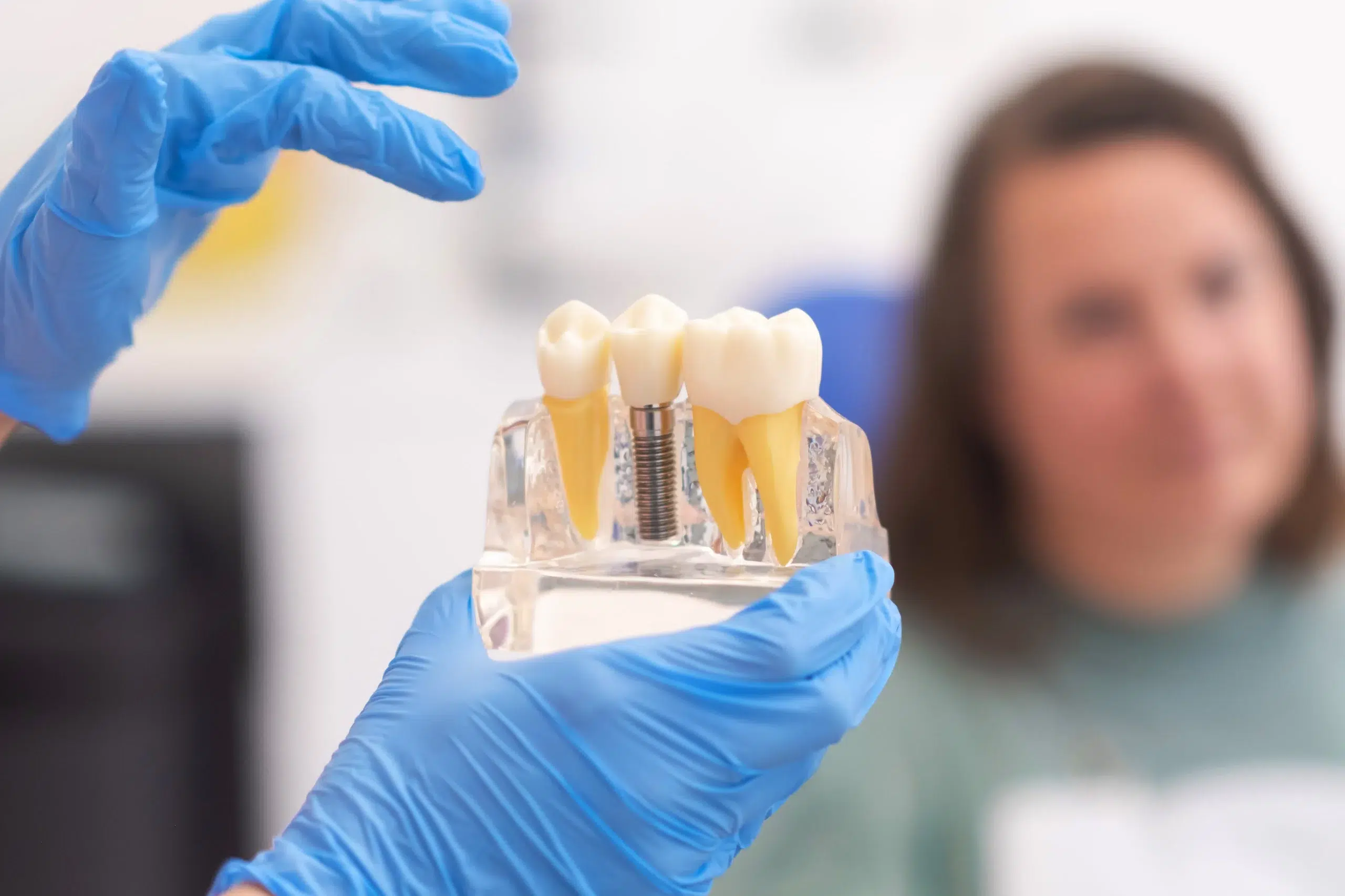 implantes dentales sin hueso