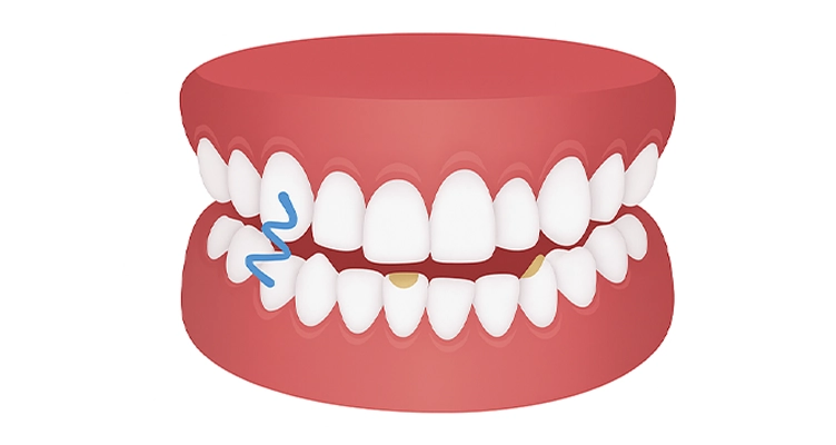 ortodoncia zaragoza precios