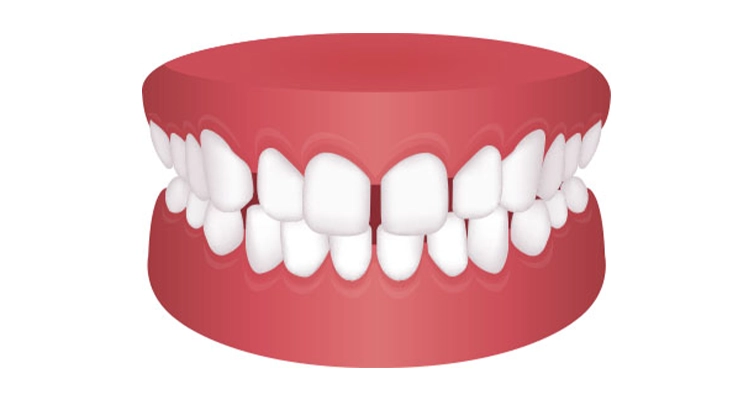 centro de ortodoncia en zaragoza