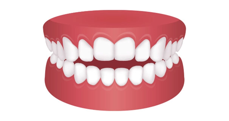 ortodoncia zaragoza precios