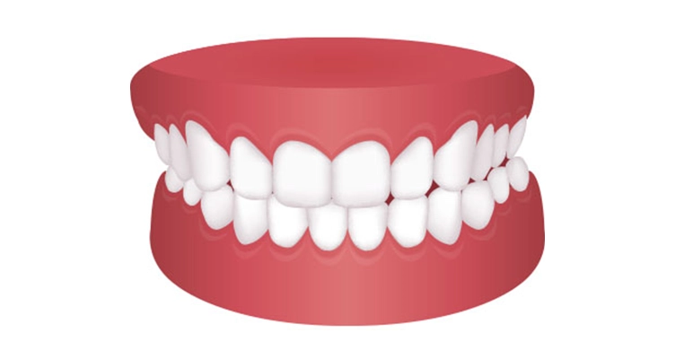 ortodoncista zaragoza