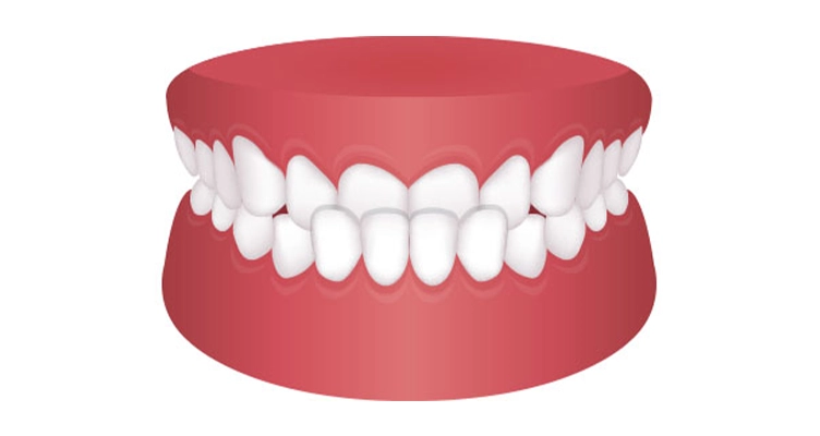ortodoncia para adultos en zaragoza