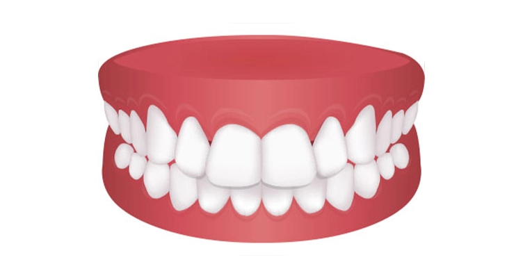 centro ortodoncia zaragoza