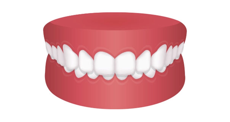 ortodoncia estetica zaragoza