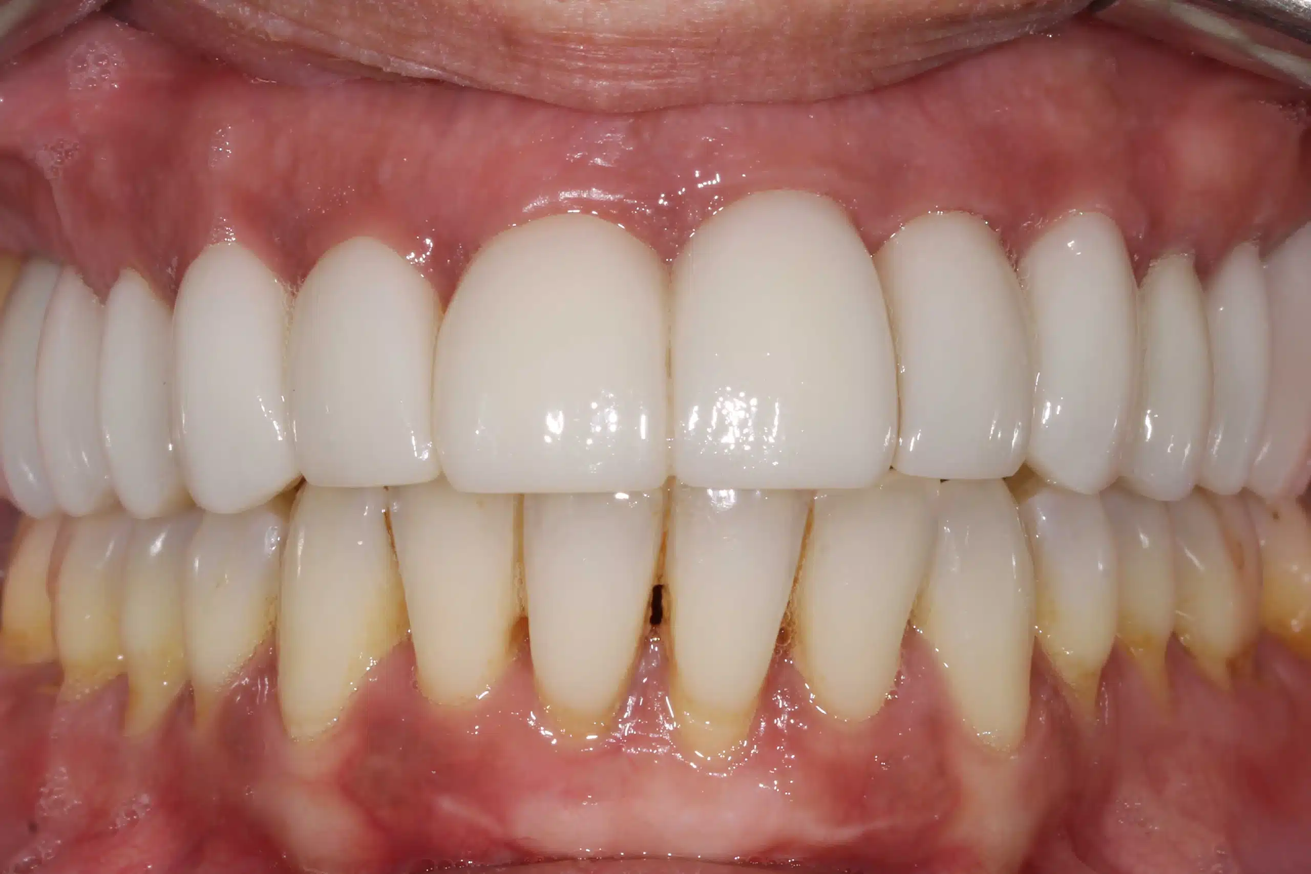 clinica dental zaragoza