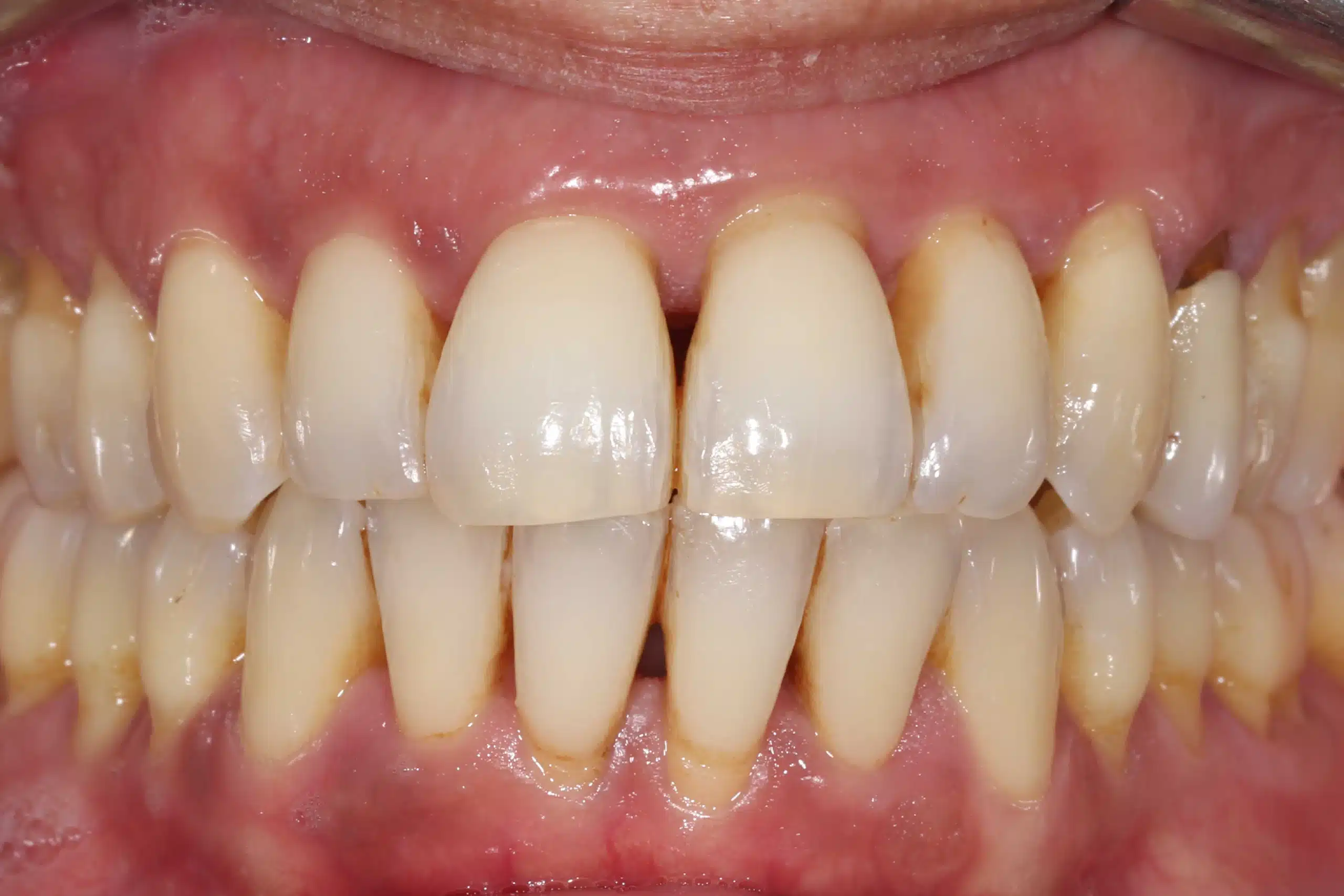 clinica dental zaragoza