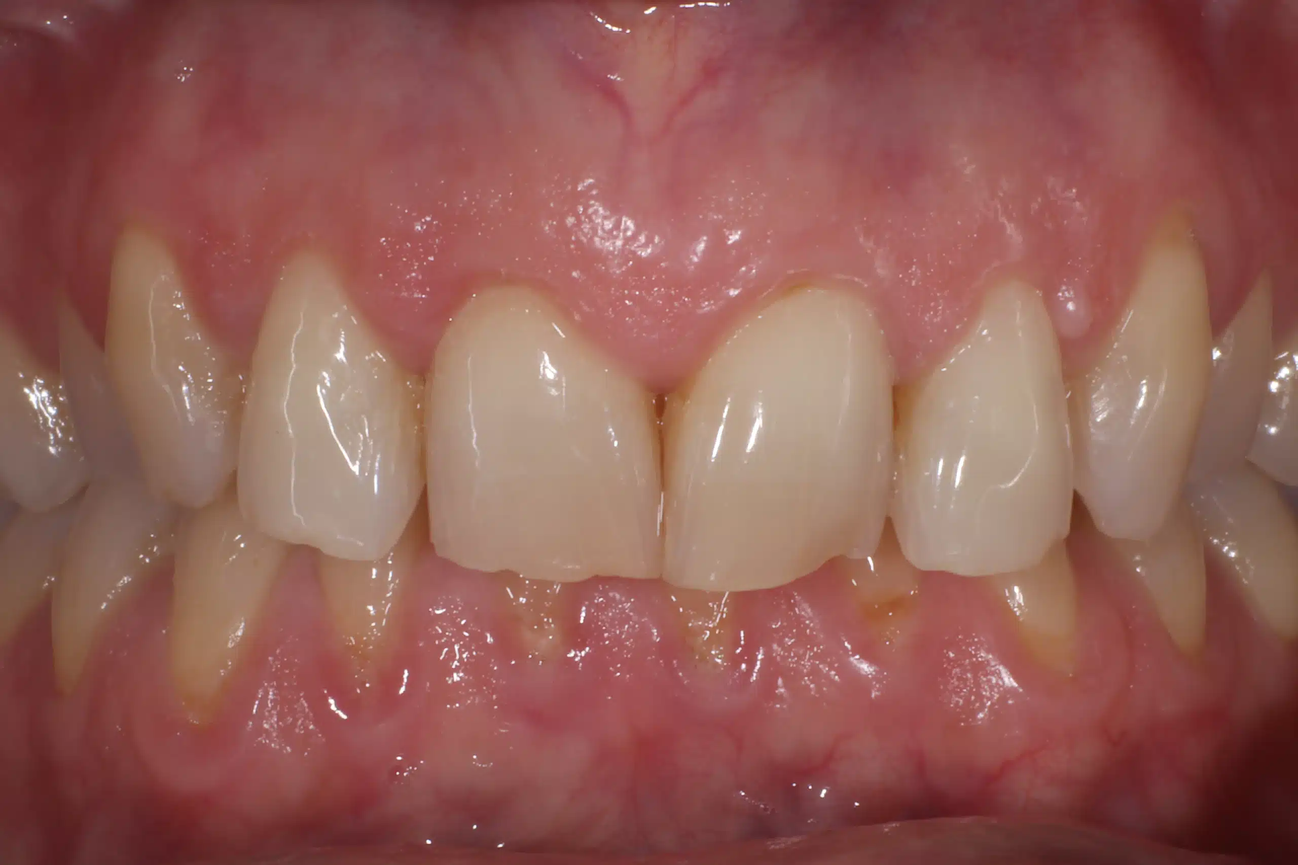 clinica dental zaragoza